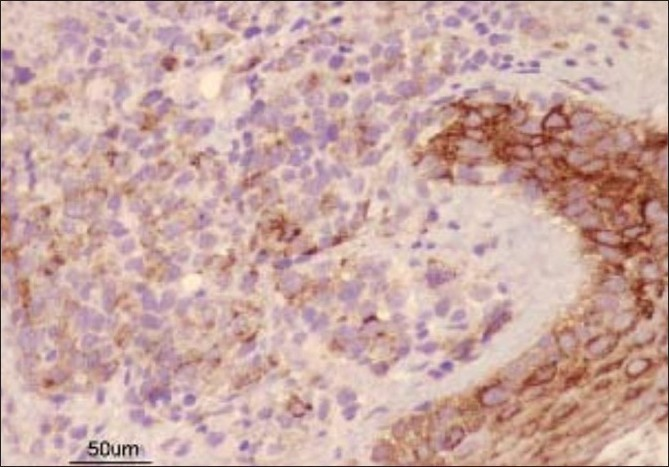 Immunohistochemistry showing EMA-negative cells