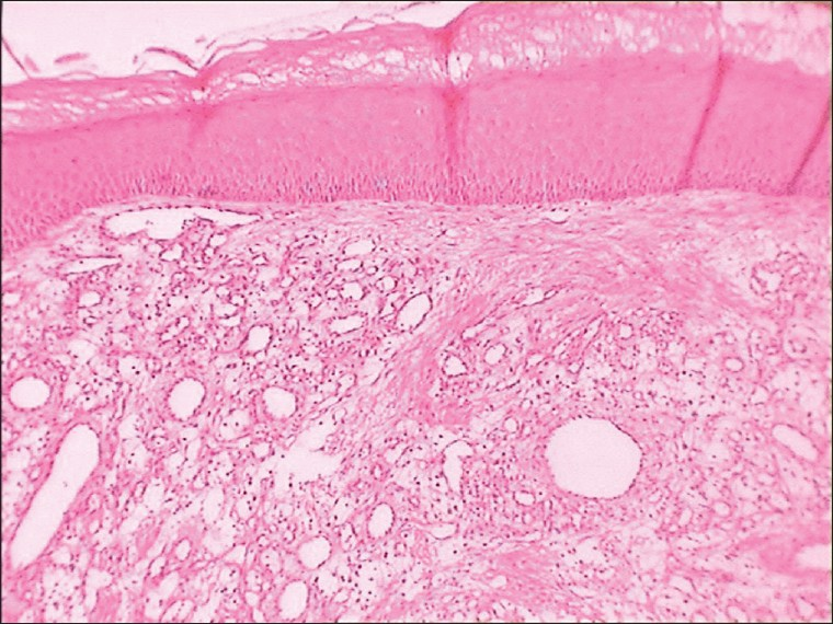 Photomicrograph of histopathological section under low magnification (10×)