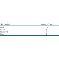 Article figure