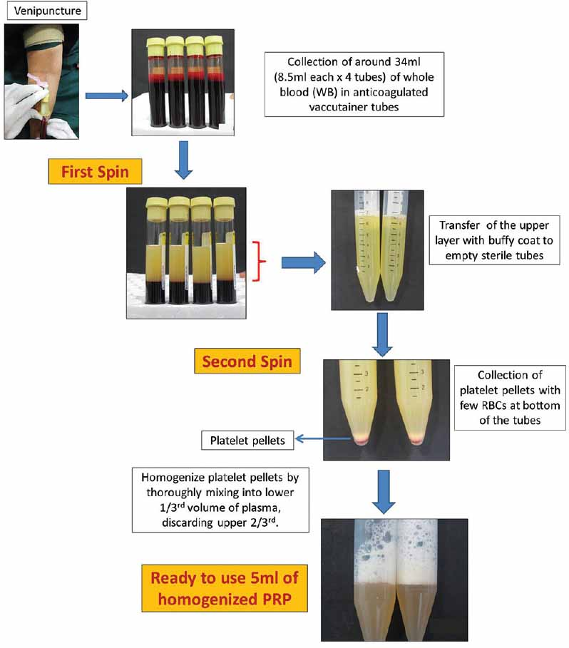 Flowchart describing preparation of PRP