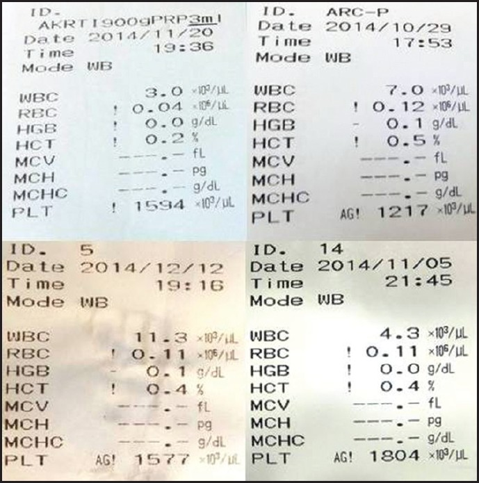 Consistency of PRP yield