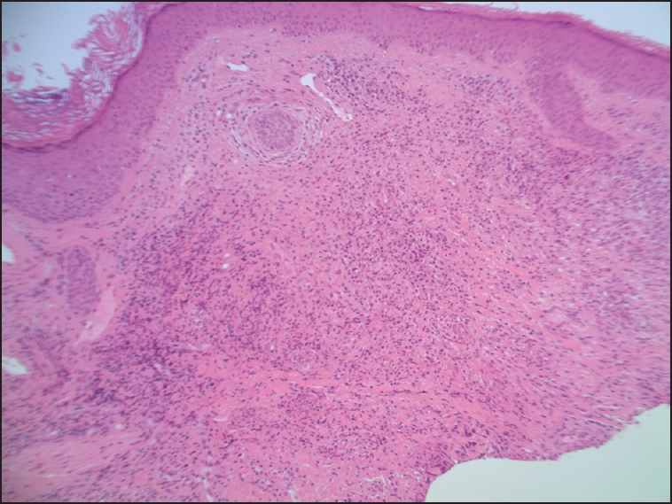 Histopathology of biopsy; mention magnification power