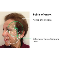 Article figure