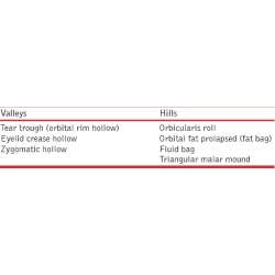 Article figure