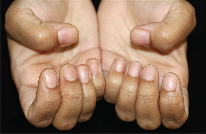 Technique for placing all finger nails in a frame