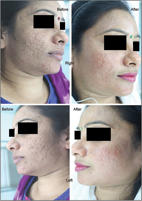 Before and after clinical photographs of patient 3