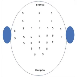 Article figure