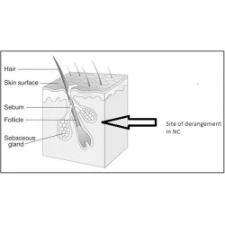 Article figure