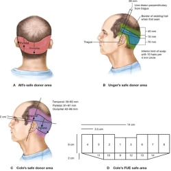 Article figure