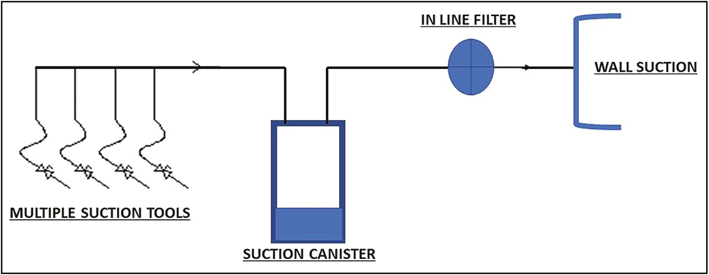 Schematic diagram of wall suction unit with an in-line filter