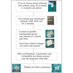 Article figure