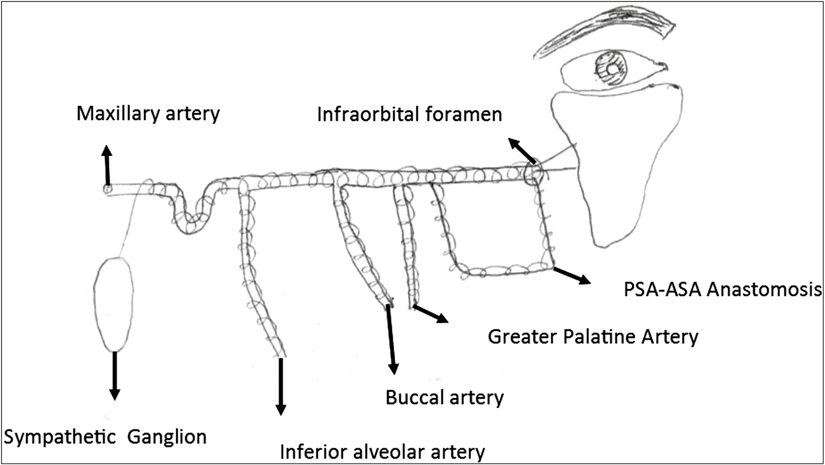 Diagram of maxillary artery and its branches, sympathetic nerve, and facial blanching in infraorbital area (PSA, Posterior Superior Alveolar artery; ASA, Anterior Superior Alveolar artery)