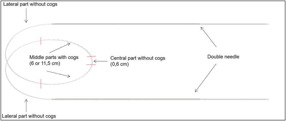 Definisse double-needle threads Two variations: 12 cm with two 6-cm-long parts with bidirectional,convergent spines; 23 cm with two 11.5-cm-long parts with bidirectional, convergent spines; a straight cut edge needle is at each extremity; central portion has no barbs