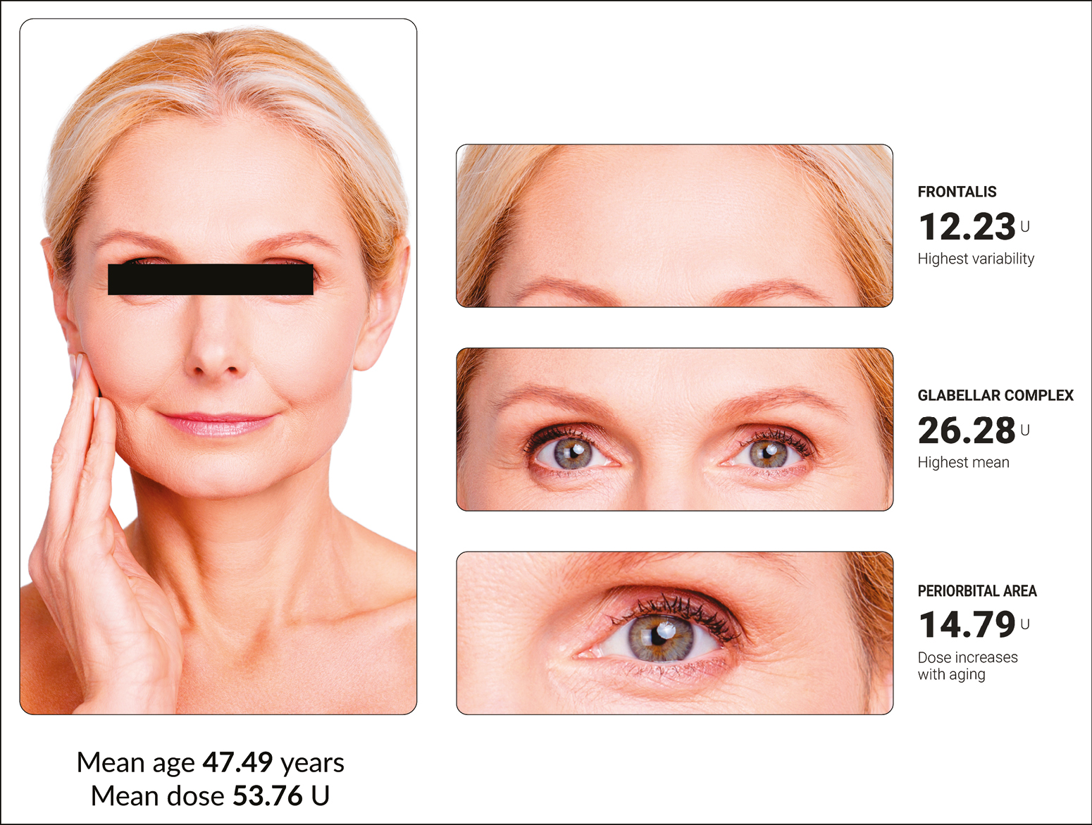 Total mean dose of botulinum toxin type A per area