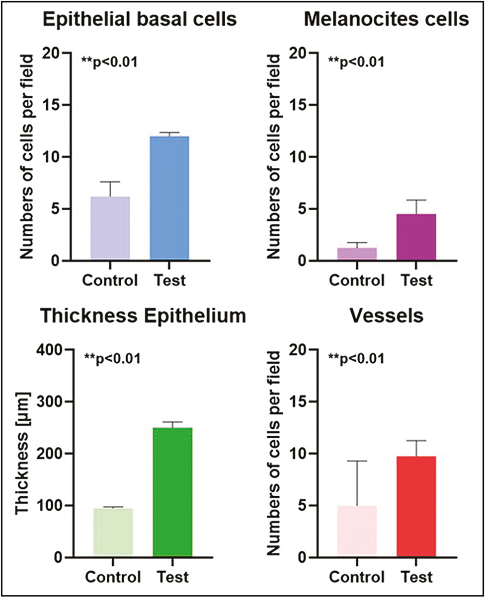 The bar graphs show the epithelial basal cells, epithelial thickness, melanocytes, and vessel number (mean, standard deviation)