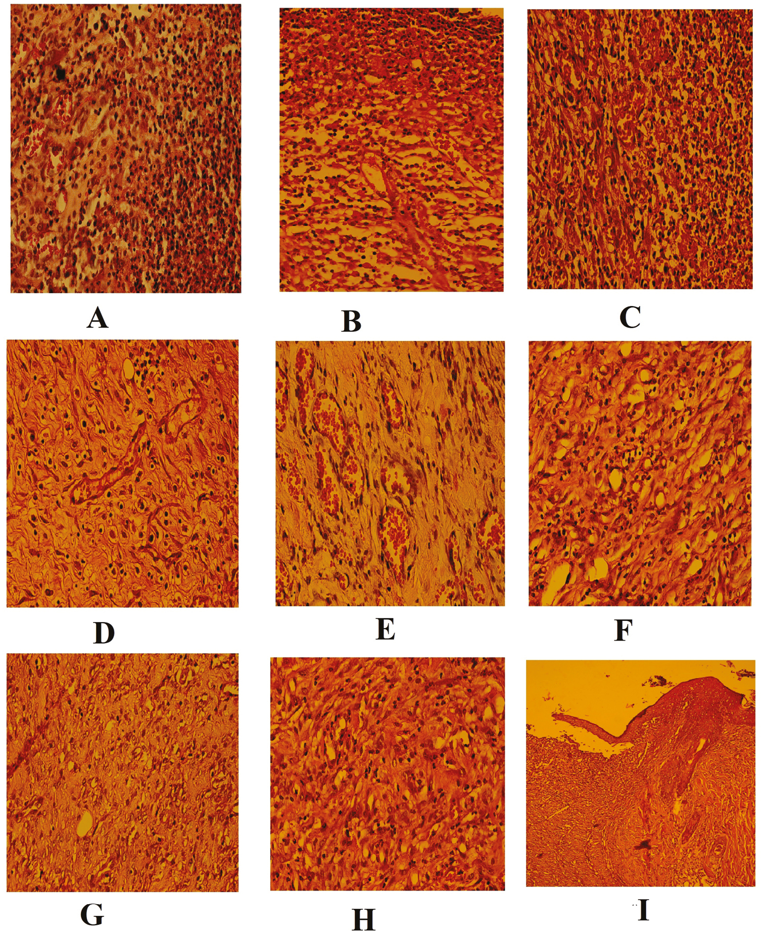 (A–I) Histopathological skin sections of WH in all the three experimental groups