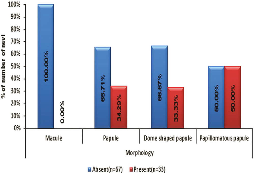 Distribution of morphology of nevi with recurrence