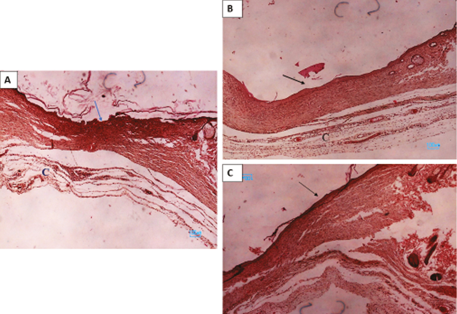 Histological images show skin repair in the control (A) and BAF (B), and LPL groups. Arrows showed wound healing in different groups and (C) collagen fiber