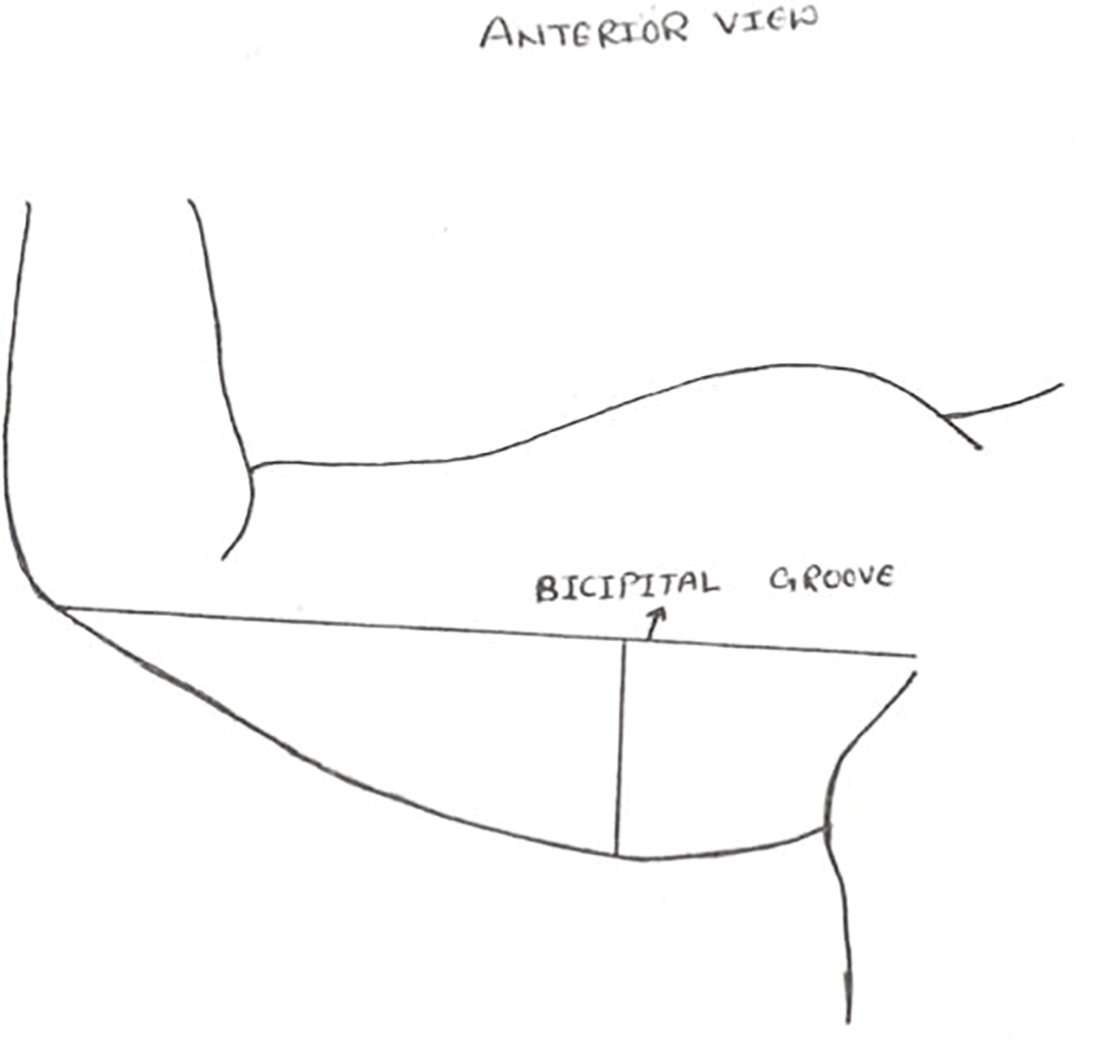 Bicipital groove imaginary line