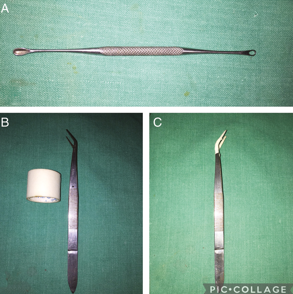 Conventional comedone extractor (A), angular dissecting forceps and micropore adhesive tape (B), and wrapped tips of forceps with tape (C)