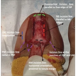 Article figure