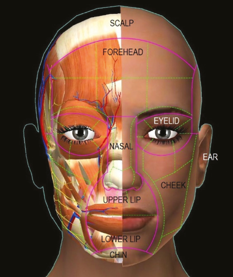 Facial subunit diagram with esthetic and underlying anatomic components. Pink lines represent unit boundaries and green lines represent subunit boundaries