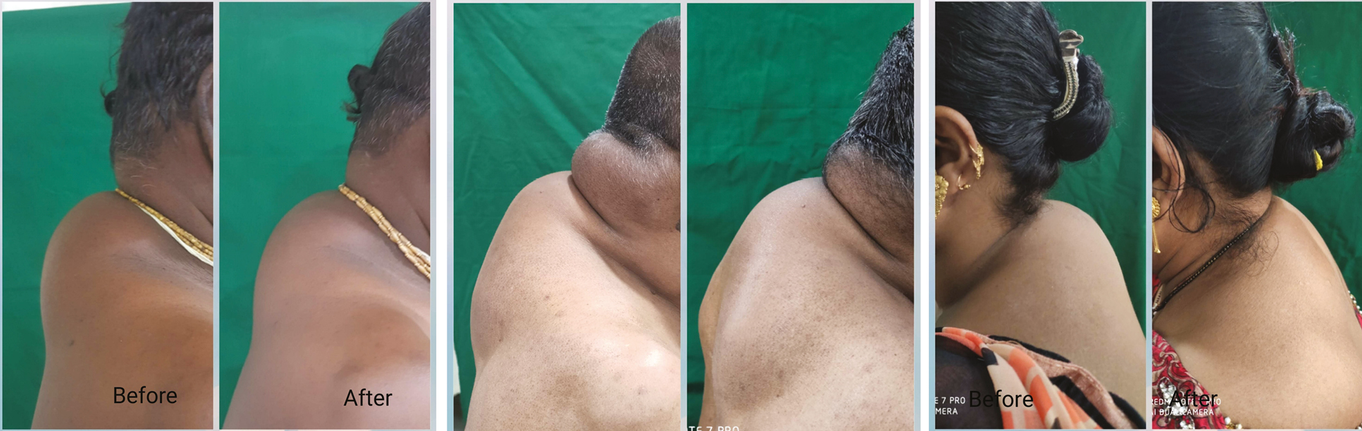 Showing before and after images of patients