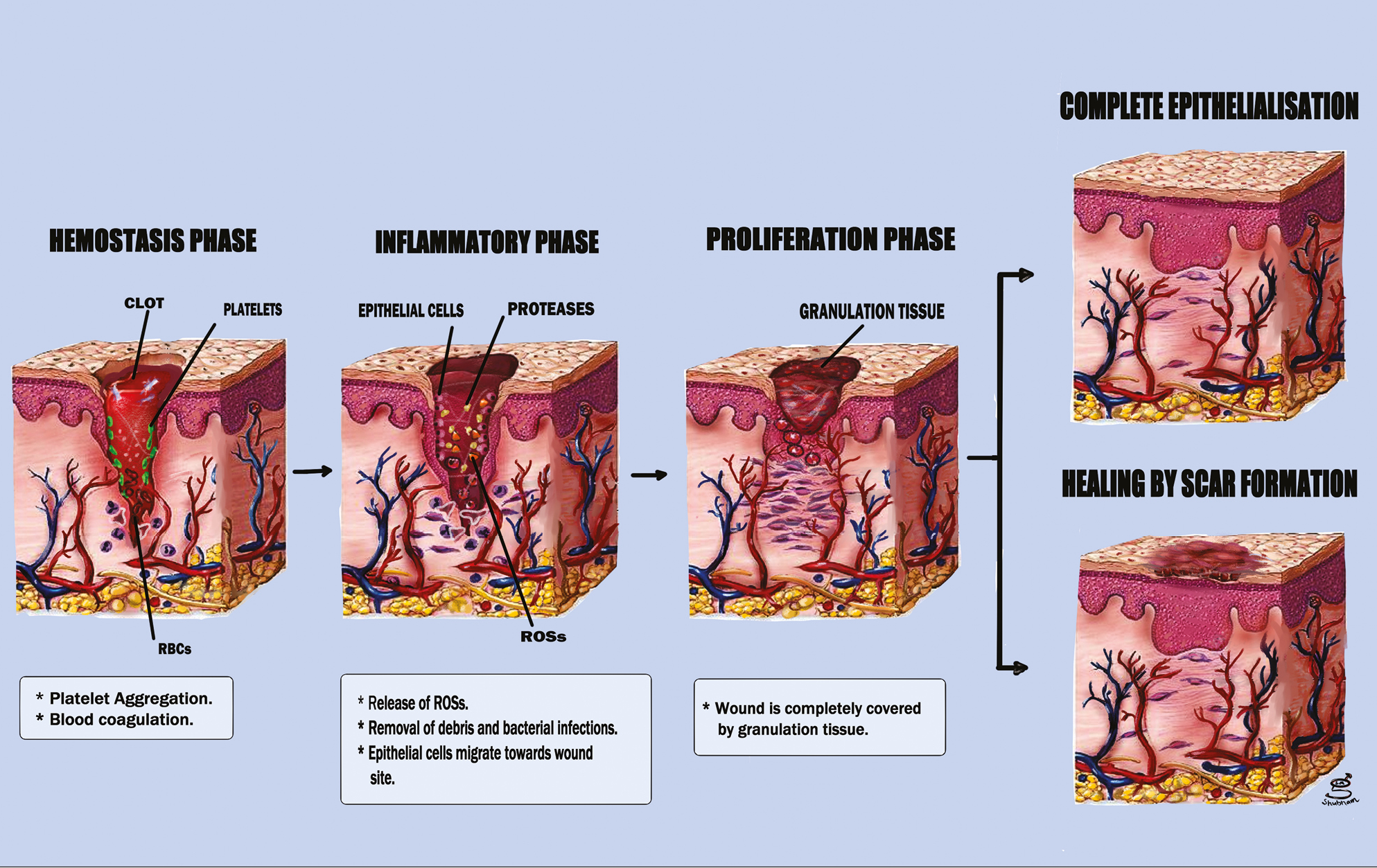 Illustrates the sequence of events in various phases of wound healing