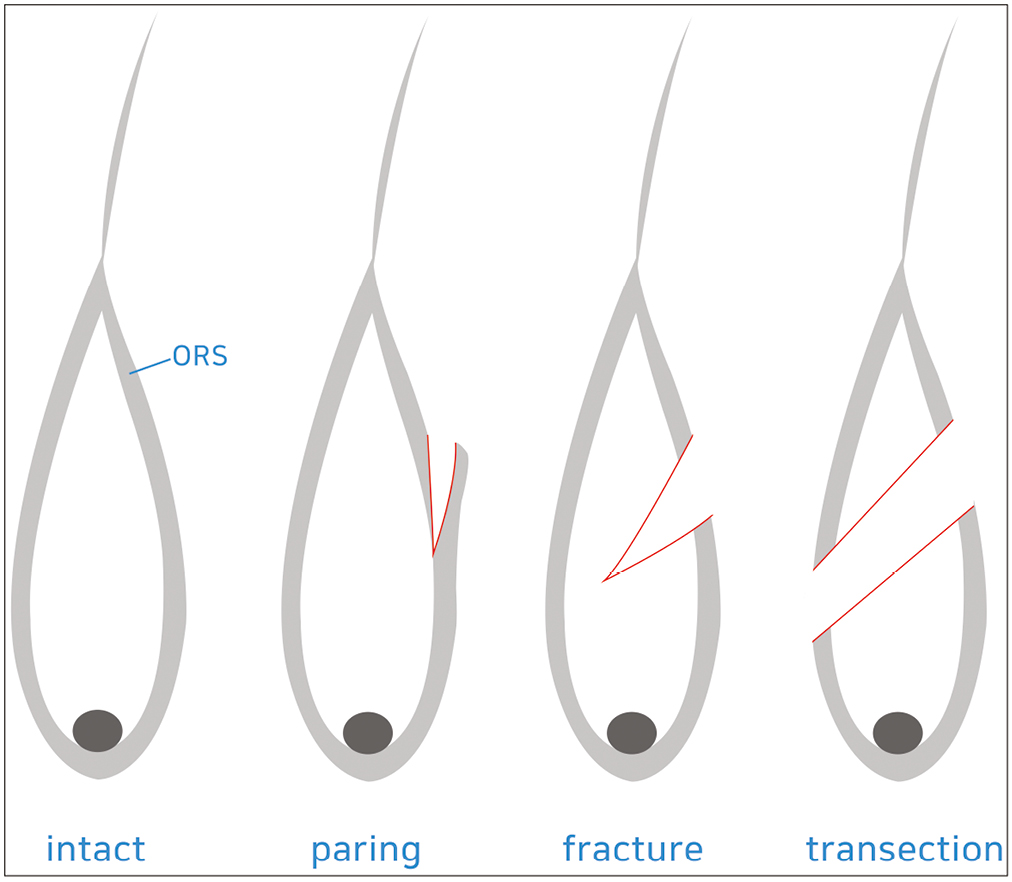 Concept schema for various minor injuries