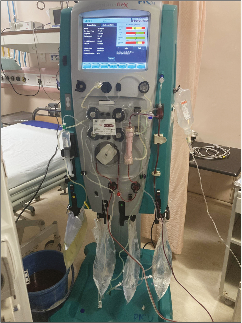 Continuous renal replacement therapy machine