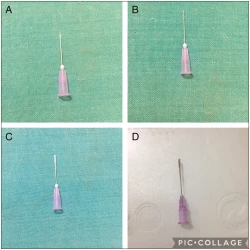 Article figure