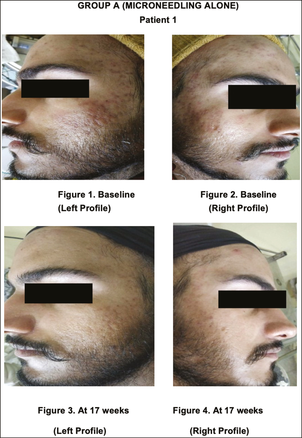 Group A, before and after photographs, (Patient 1)