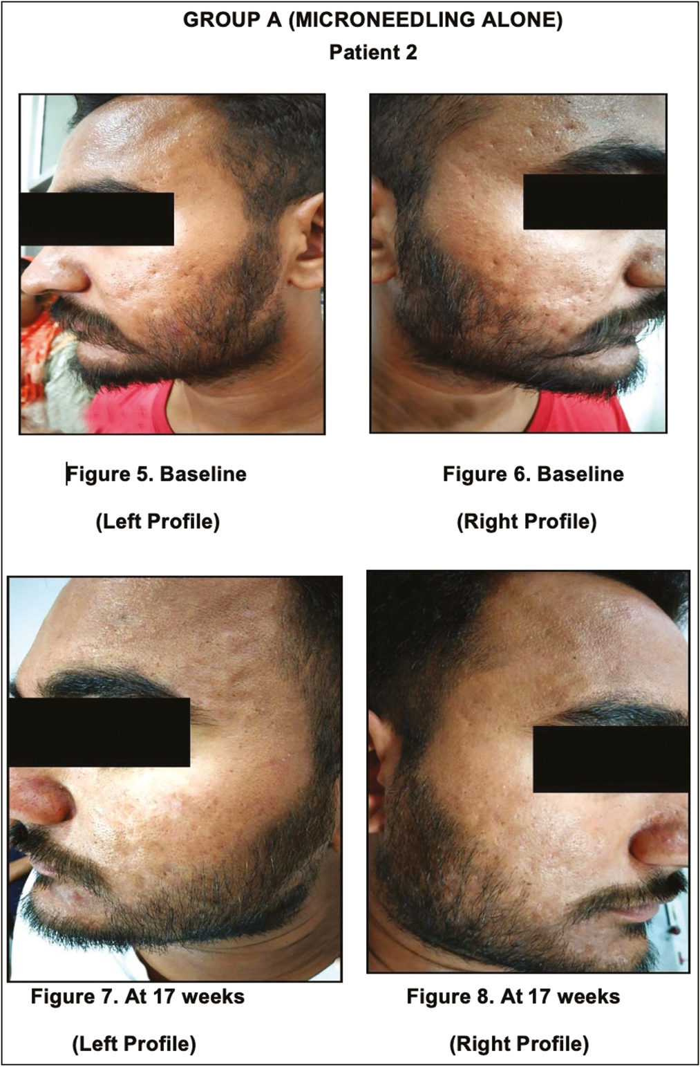 Group A, before and after photographs, (Patient 2)