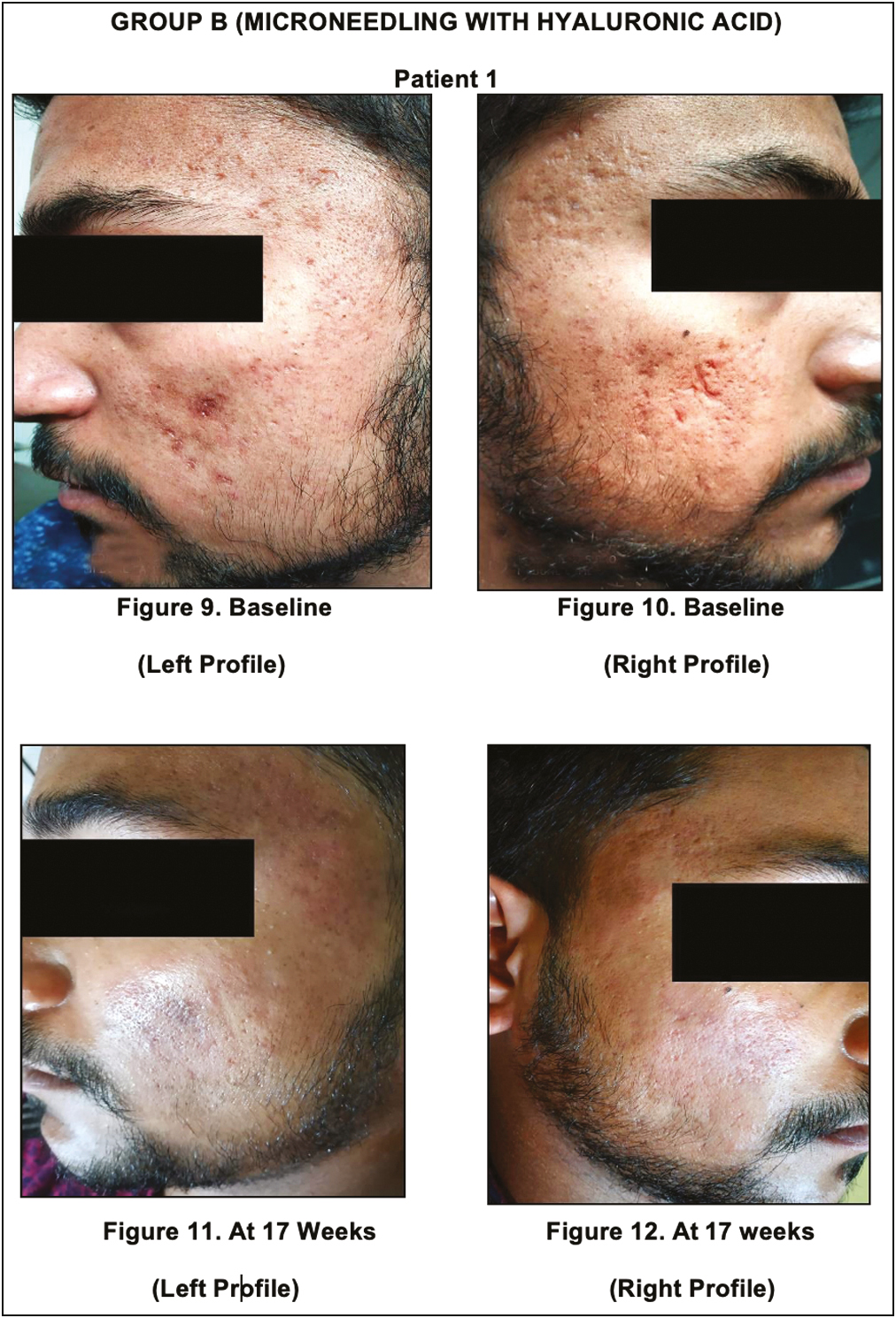 Group B, before and after photographs, (Patient 1)