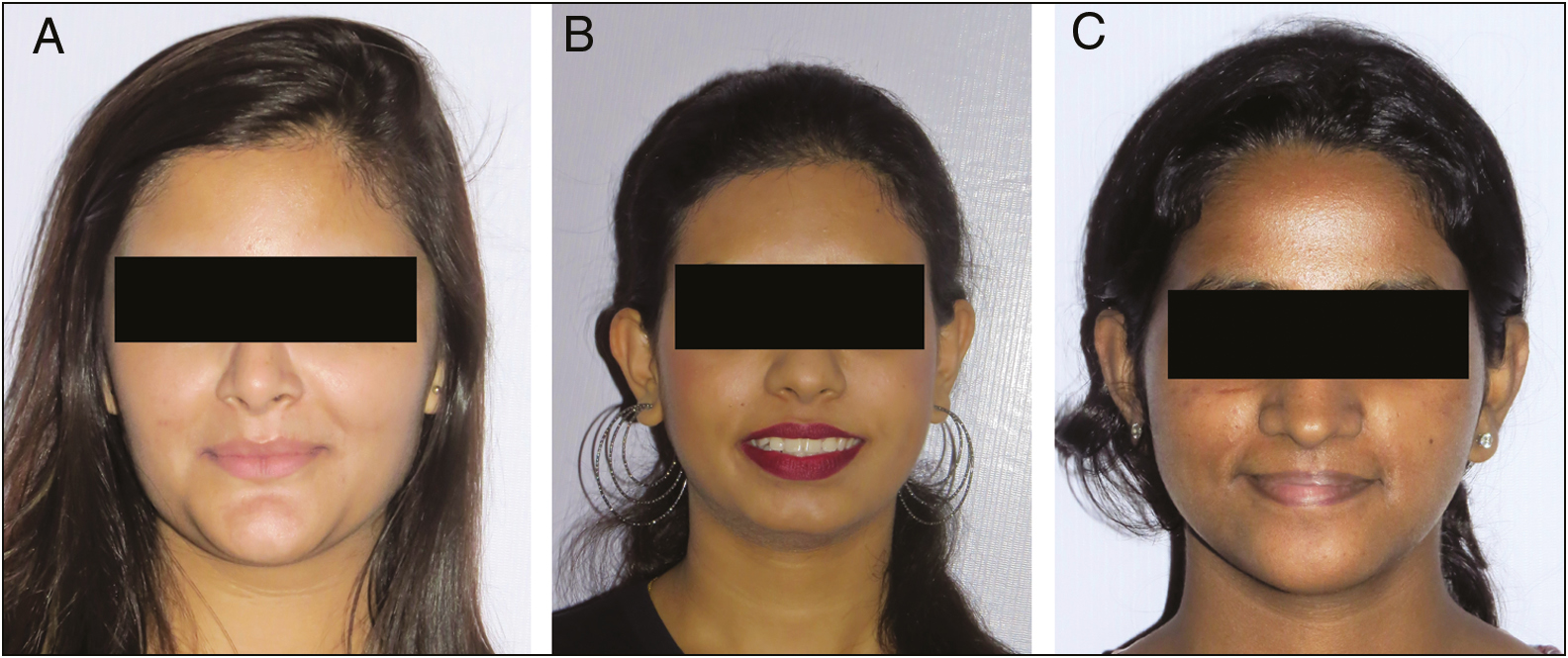 Facial appearance of the females in the study labelled A, B, C.