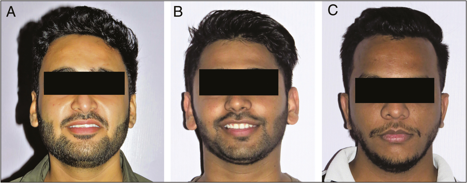 Facial appearance of the males in the study labelled A, B, C.