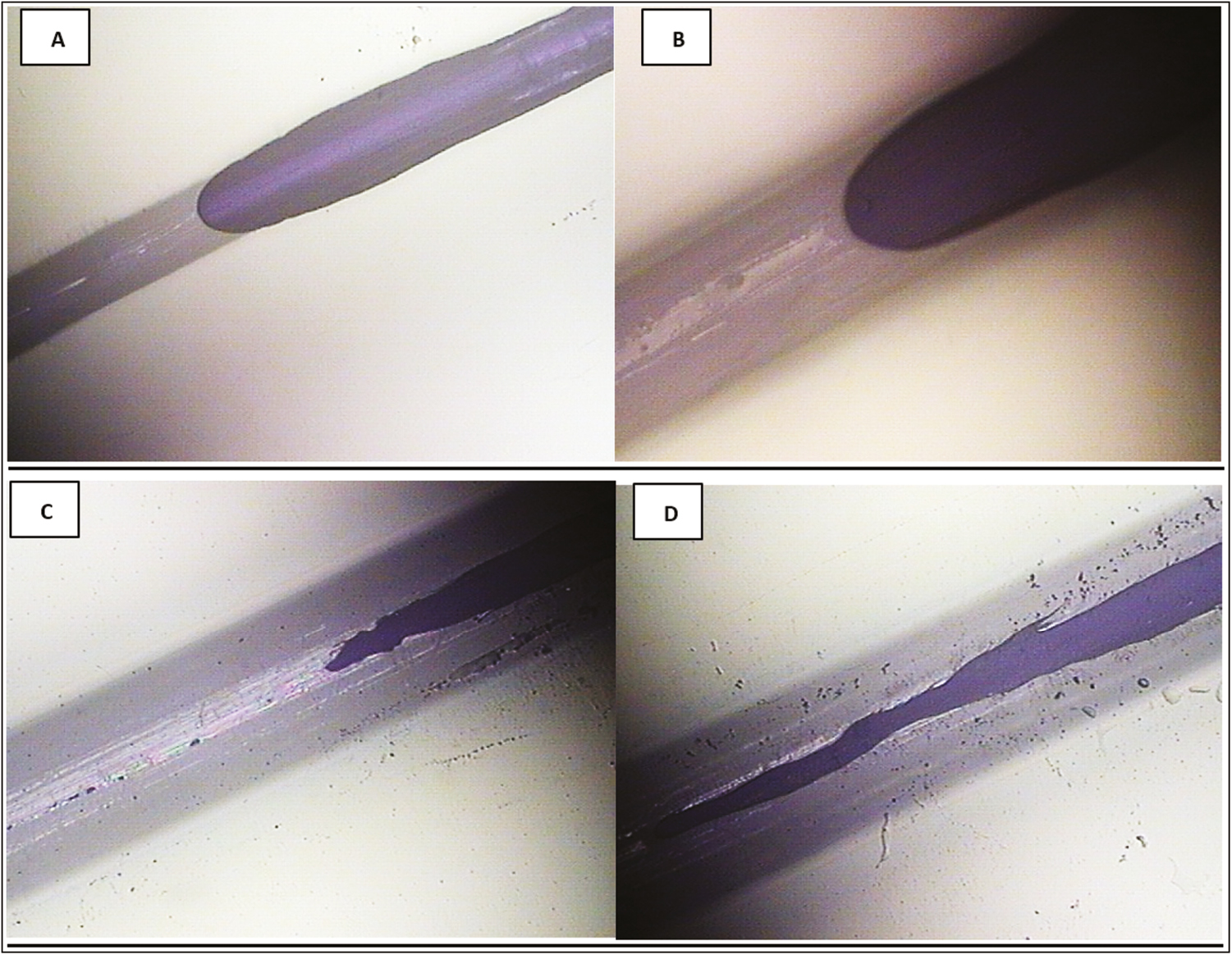 Capillarity of the PDO thread after 48 h of immersion in Arg. (A and B) Optical photomicrographs of reflection of the thread at 10× and 4×, in which the phenomenon of capillarity is denoted by the effect of fluid absorption along the filament from the embedded part to the dry area of the thread, without completely submerging the thread in the aqueous medium of the active ingredient. (C and D) PDO thread after 72 h of immersion in Arg at 10×. Note the increase in the thickness of the thread and the interpenetration of the fluid in the central column of the suture, as well as the migration of the amorphous zone to the crystalline zone of the polymer in the suture