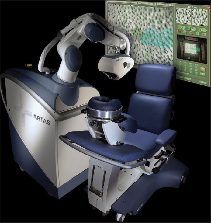 ARTAS Robotic system.