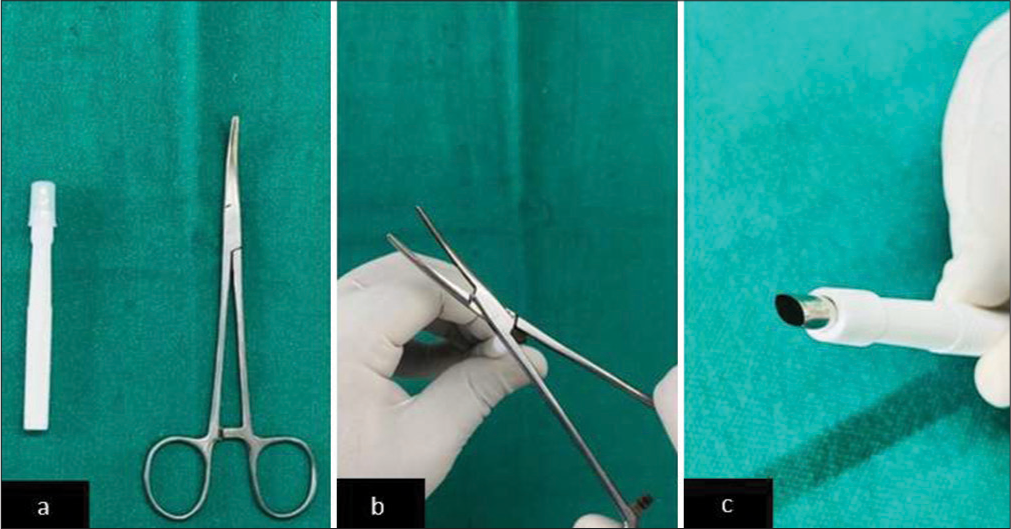 (a) Biopsy punch and artery forceps, (b) compressing the biopsy punch to give elliptical margins, and (c) biopsy punch with uniform margin and angle of 30° at each margin.