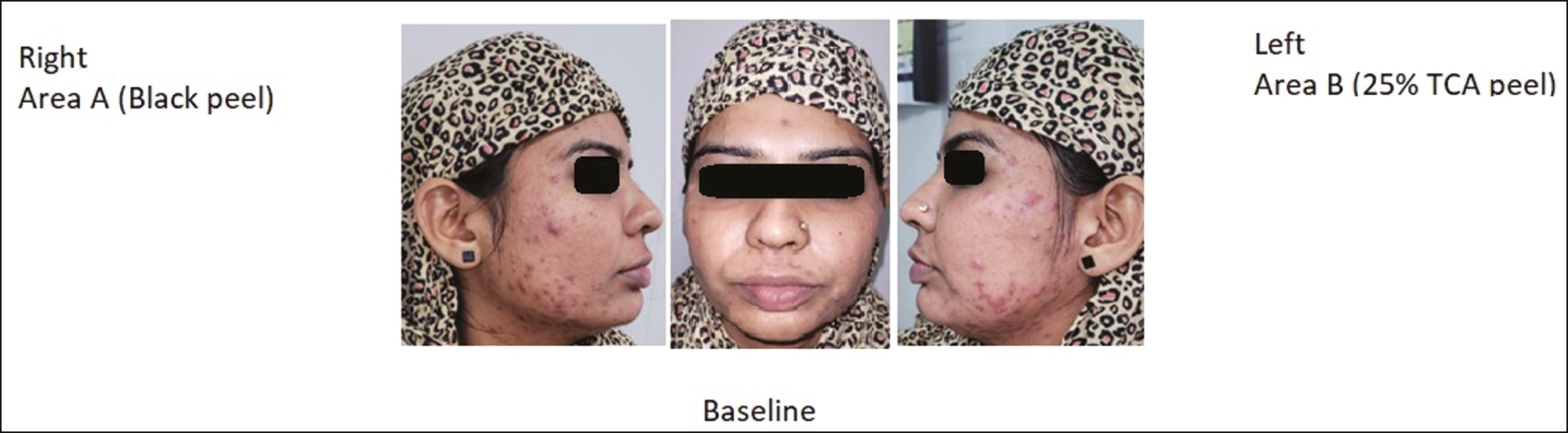 Baseline picture of 22-year-old patient in both the groups