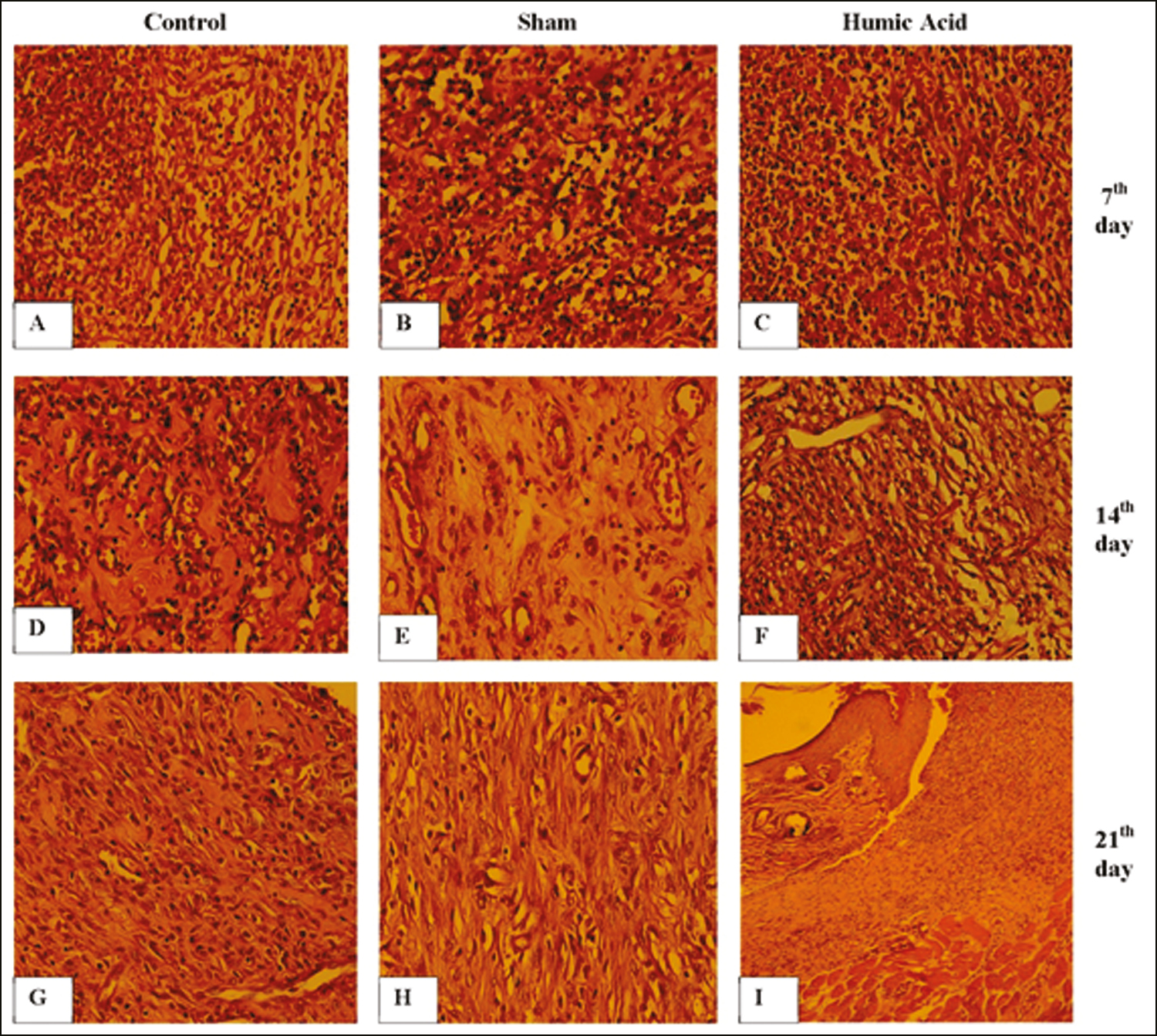 (A–I) Histomorphologic results of wound healing in all three groups. The infiltration of inflammatory cells, fibroblast proliferation, and angiogenesis in the control (A, D, G), the sham (B, E, H) and the humic acid (C, F, I) at days 7, 14, and 21 posttreatment, respectively. Hematoxylin and eosin staining, 400× and 100× (I)