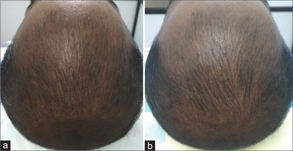 No change (0). (a) Before treatment. (b) After treatment.