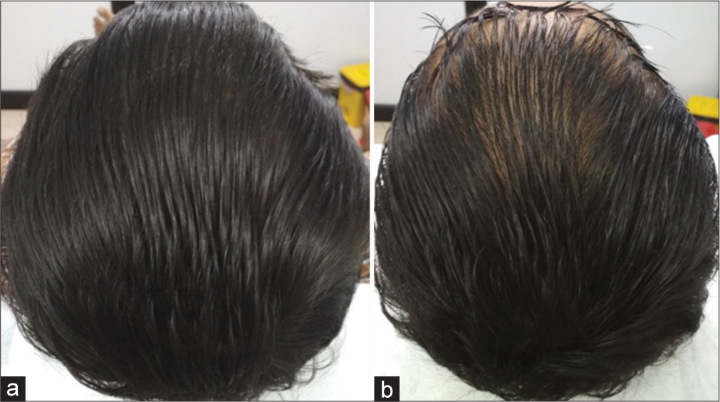 Slight Worsening (−1). (a) Before treatment. (b) After treatment.