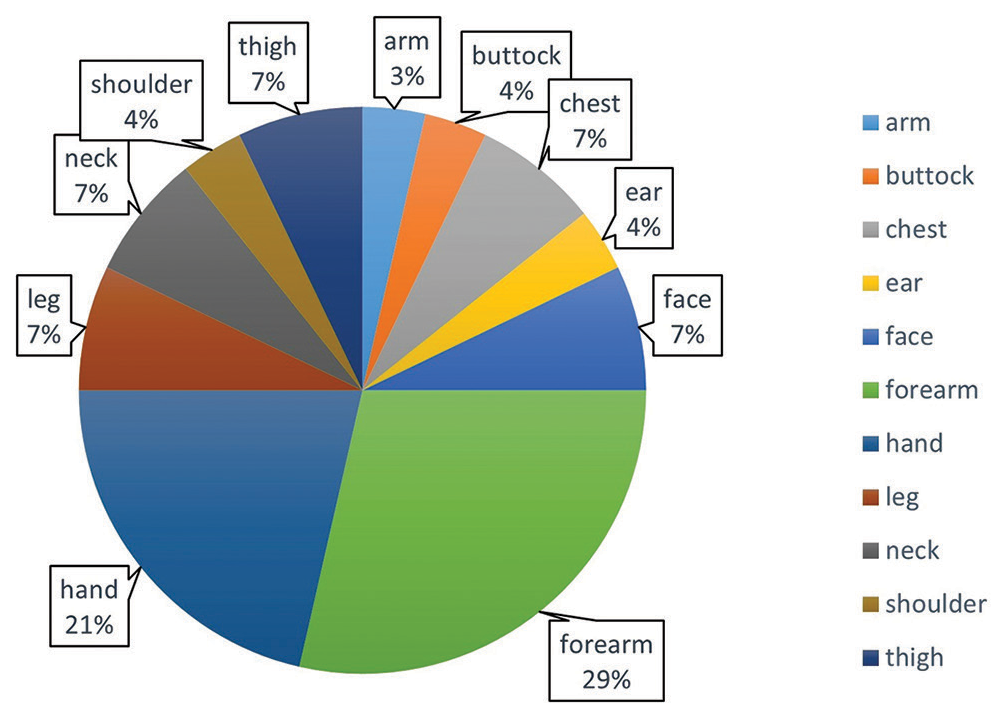 Pie chart showing the distribution of sites of scar area.