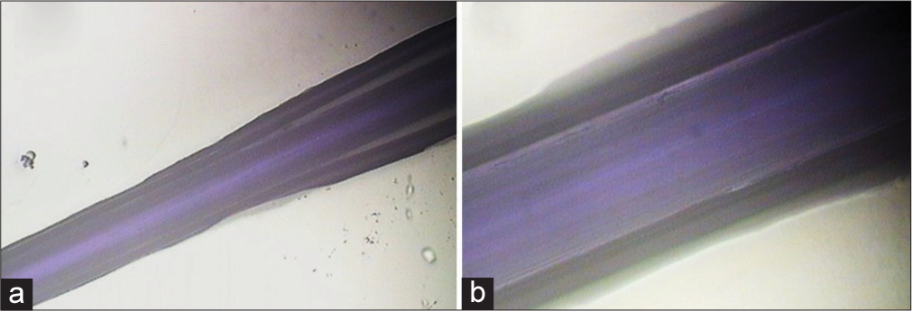 Polydioxanone (PDO) thread after 24, 48, and 72 h of immersion in organic silicon. (a) ×4. The central area of the thread is surrounded by light-dark areas due to the retention of the drug. (b) ×10. An increase in interfibrillar and interlaminar spaces corresponds to the phenomenon of fluid absorption or capillarity of the PDO.