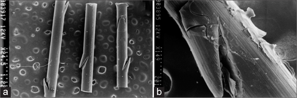 (a) Topography of the polydioxanone (PDO) thread without the drug (control) scanning electron microscopy (SEM) microphotograph at ×25. Spicular slits are observed on the lateral edges. (b) PDO thread with Arg. SEM microphotograph at ×150. A layer covers the wire and interpenetrates the fiber cleft corresponding to the silicon on the PDO surface.