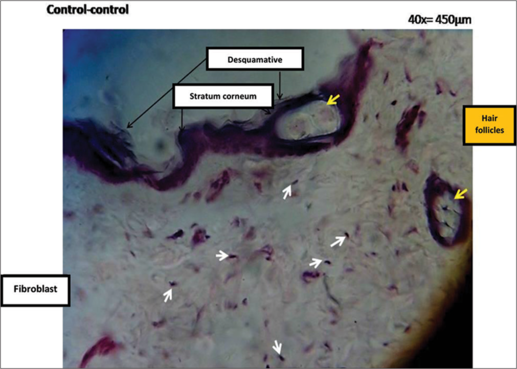 Microphotograph of a histological section of the skin control-control group of the BIOU line: The stratum corneum is identified (the black arrows at the top of the histological preparation indicate the purple band corresponding to the stratum corneum) with its scaly cells (translucent strand located on the purple band or stratum corneum, layer indicated with black arrows), fibroblasts (white arrows indicating purple nuclei of fibroblasts in the dermis), pilosebaceous units in the dermis (yellow arrow on the right margin) and a follicle in the background behind the epidermis (yellow arrow in the purple stratum, above).