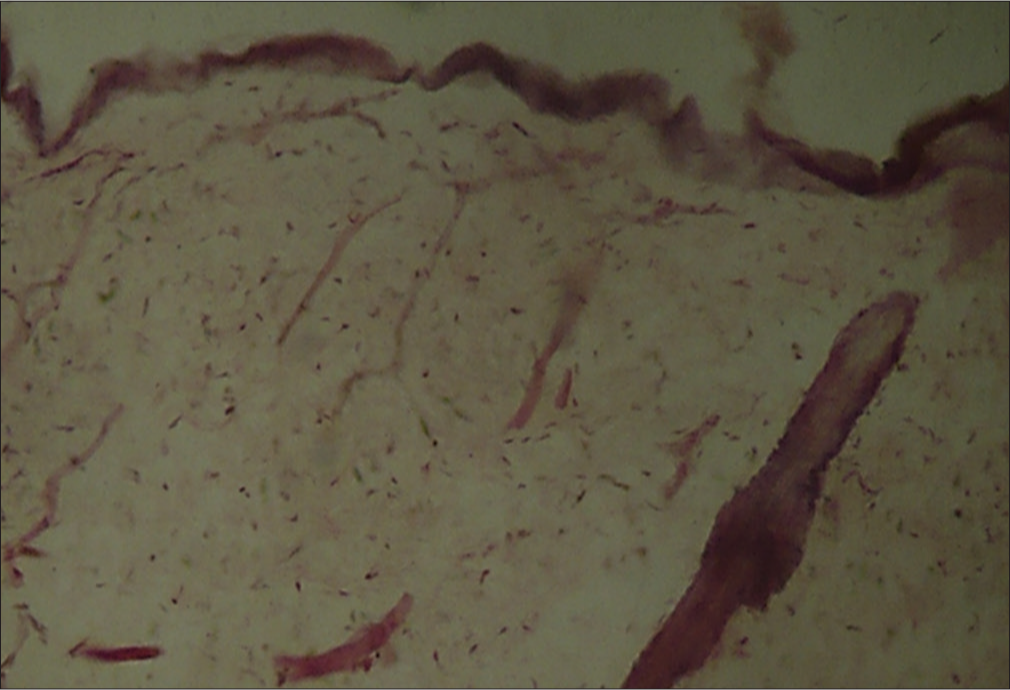 Photomicrograph hematoxylin and eosin-stained histological section of skin (×40) representative of dense avascular connective tissue and absence of inflammatory infiltrate in the experimental group.