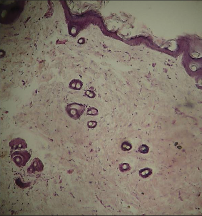 Photomicrograph hematoxylin and eosin-stained histological section of skin (×40). Elevated fibroblast cellularity was observed in the experimental group.