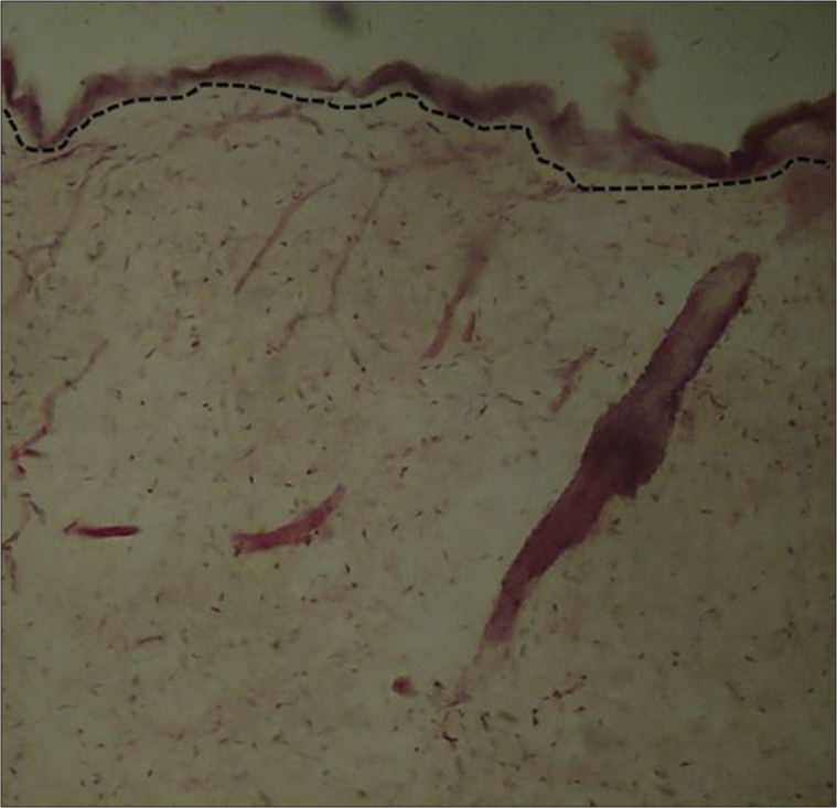 Photomicrograph hematoxylin and eosin-stained histological section of skin (×10). The dotted black line borders the shape of the basement membrane that has been rectified by the thick epidermal thickness in the experimental group